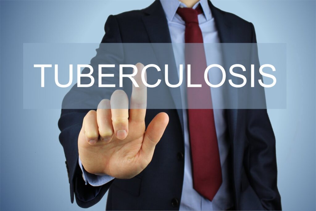 Tuberculosis (TB): A Comprehensive Overview